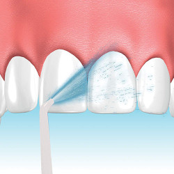 Jet dentaire rechargeable Hydropulse